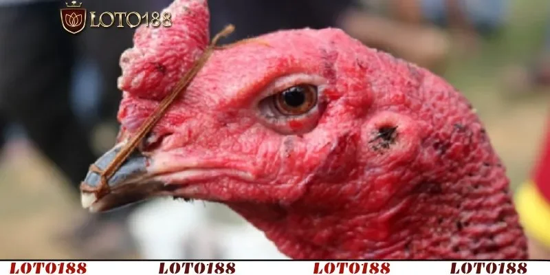 Bệnh lác, biểu hiện điển hình và cách xác định bệnh sớm